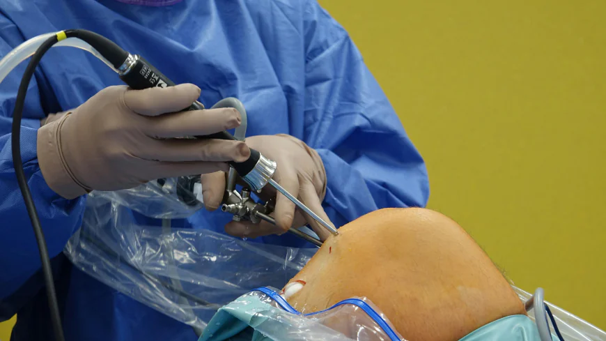 Trauma Surgery After Injury: From Accident Scene to Operating Room