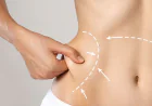 Best Age for Body Contouring in Islamabad