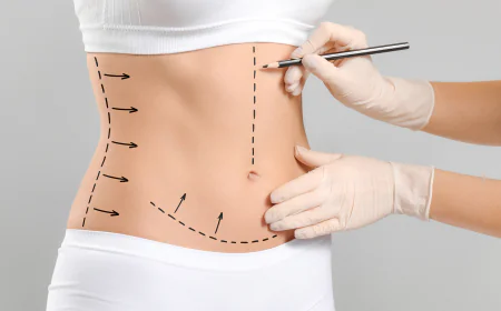 Why More Pakistanis Are Choosing Body Contouring in Islamabad