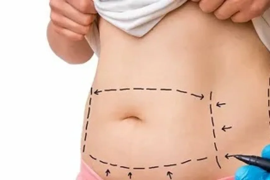 Liposuction Surgery in Islamabad: Pain, Procedure & Recovery Guide
