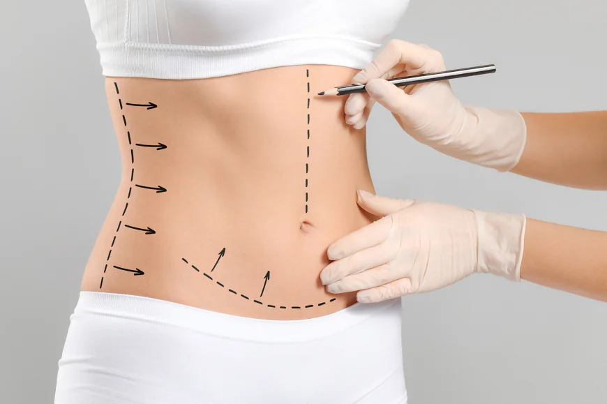 Why More Pakistanis Are Choosing Body Contouring in Islamabad
