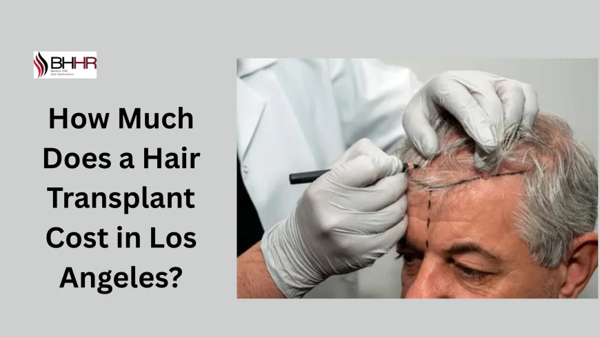 How Much Does a Hair Transplant Cost in Los Angeles?