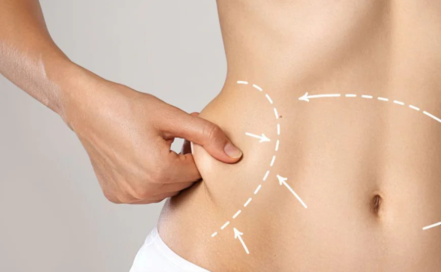 Best Age for Body Contouring in Islamabad